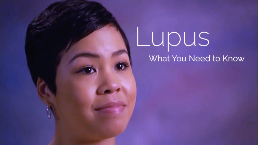 Home Page - The Lupus Initiative